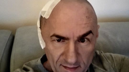 Mieszkaniec Gorzowa walczy z ciężką chorobą. Rodzina prosi o pomoc