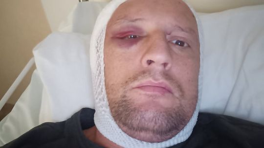 Życie tego mężczyzny zmieniło się w jeden dzień