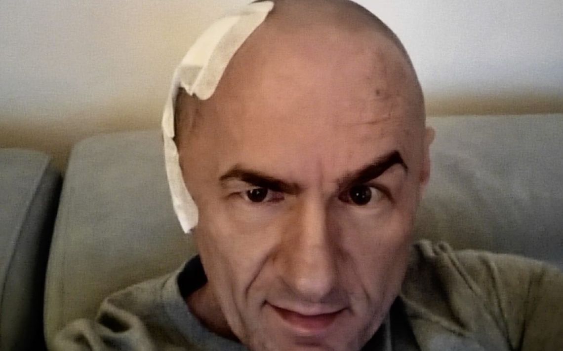 Mieszkaniec Gorzowa walczy z ciężką chorobą. Rodzina prosi o pomoc