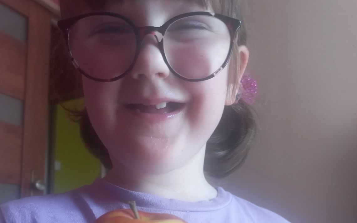 Niepełnosprawna dziewczynka potrzebuje wsparcia. Apel matki porusza